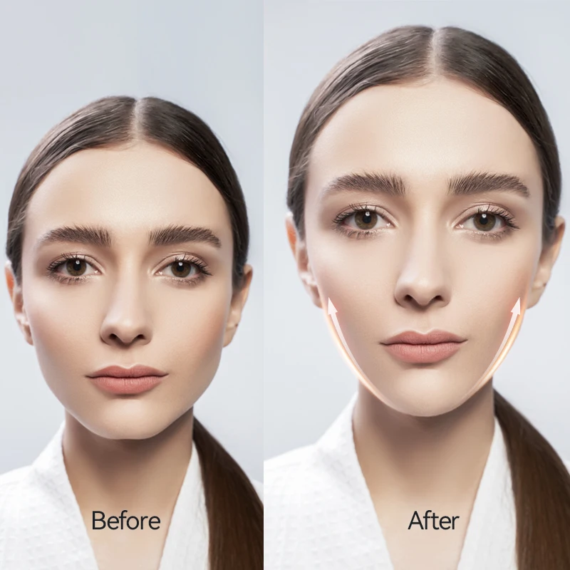 v line face lift tools Face Fat Burning Double Chin Remover Machine - Image 5